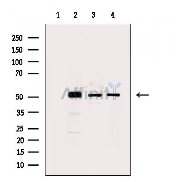 alpha Tubulin Antibody - Western blot analysis of extracts from various samples, using alpha Tubulin Antibody.