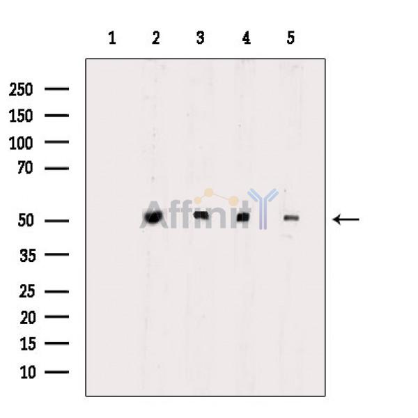 alpha Tubulin Antibody - Western blot analysis of extracts from various samples, using alpha Tubulin Antibody.