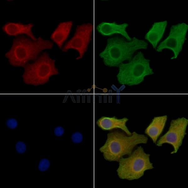 c-Met Antibody - AF6128 staining Hela cells by IF/ICC.
