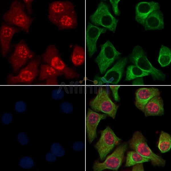 LIMK1 Antibody - AF6345 staining Hela cells by IF/ICC.