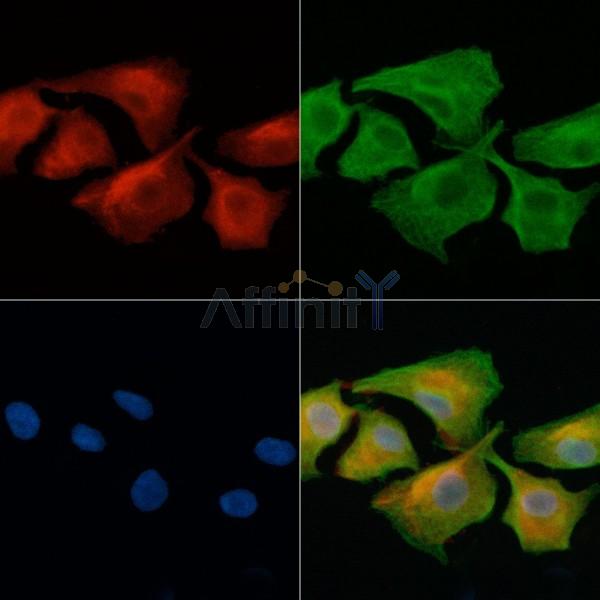 IFNAR1 Antibody - AF6717 staining A549 cells by IF/ICC.