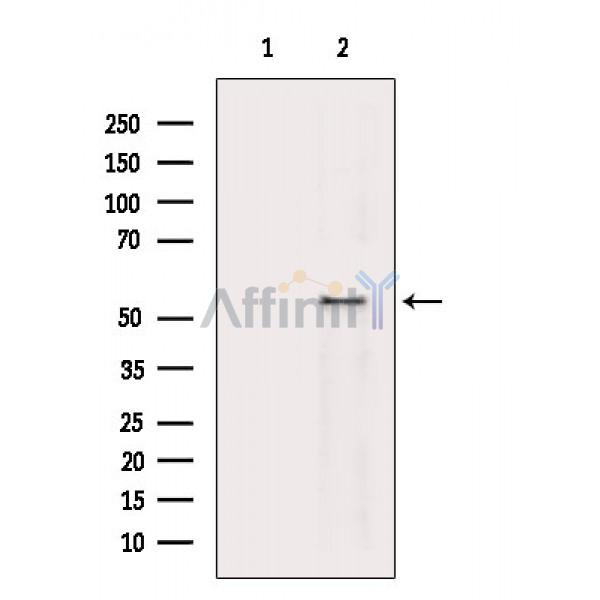 Phospho-p53 (Thr55) Antibody - Western blot analysis of extracts from Mouse liver, using Phospho-p53 (Thr55) Antibody.