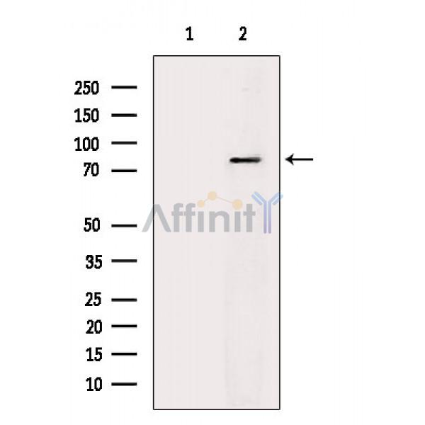 ZNF750 Antibody - Western blot analysis of extracts from Mouse lung, using ZNF750 Antibody.