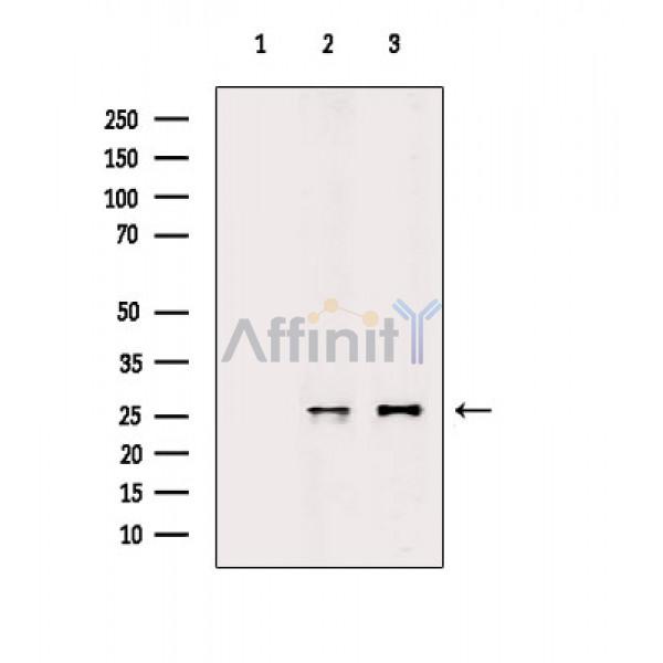 BCA3 Antibody - Western blot analysis of extracts from various samples, using BCA3 Antibody.