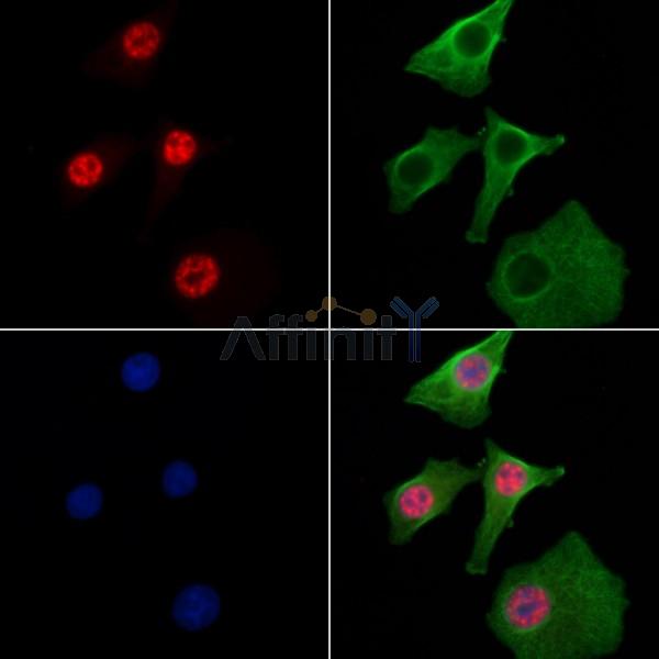 BCLAF1 Antibody - DF3828 staining Hela cells by IF/ICC.