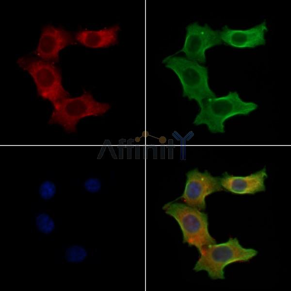 S100A3 Antibody - DF4354 staining Hela cells by IF/ICC.