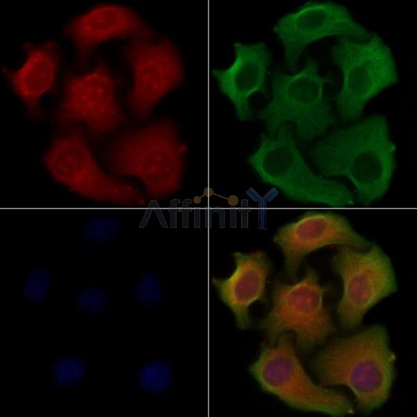 RAB37 Antibody - DF4403 staining Hela cells by IF/ICC.