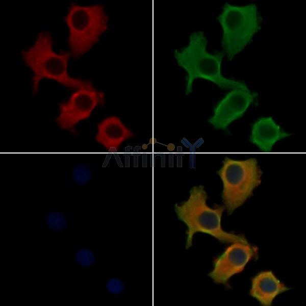 RAB6C Antibody - DF4408 staining Hela cells by IF/ICC.