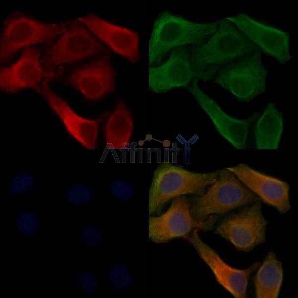 RGS7 Antibody - DF4418 staining Hela cells by IF/ICC.