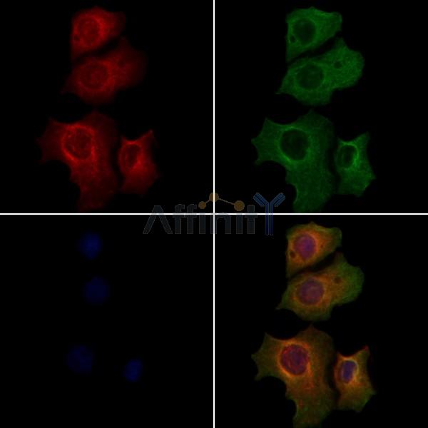 RPTN Antibody - DF4420 staining Hela cells by IF/ICC.