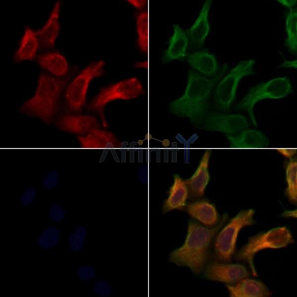 ARHGEF10 Antibody - DF4430 staining Hela cells by IF/ICC.