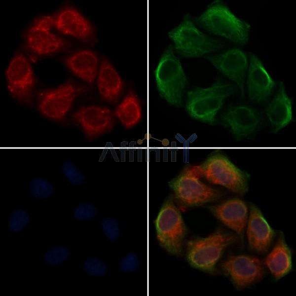 SHB Antibody - DF4495 staining Hela cells by IF/ICC.