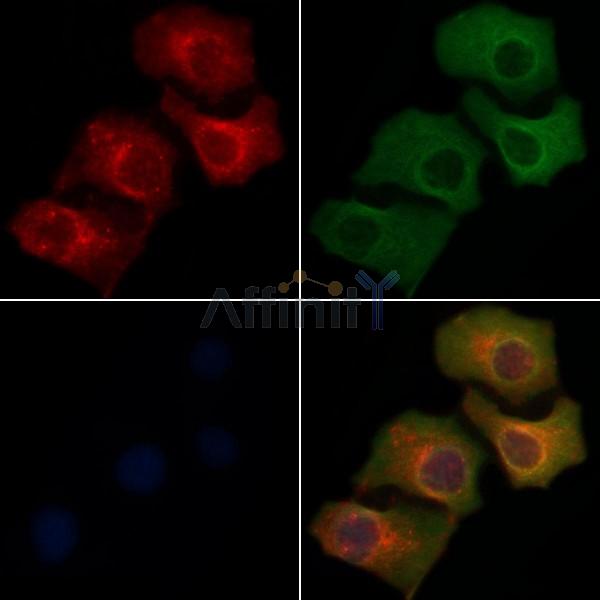 SH2D5 Antibody - DF4498 staining Hela cells by IF/ICC.