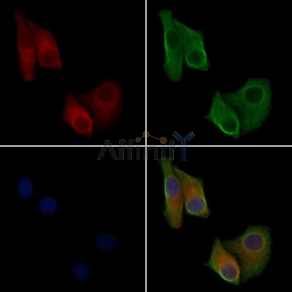 SH2B2 Antibody - DF4499 staining Hela cells by IF/ICC.
