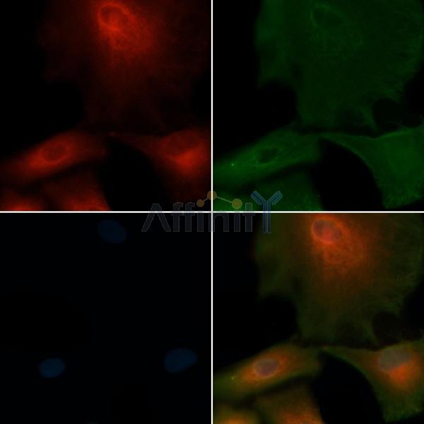 SLC4A8 Antibody - DF4532 staining A549 cells by IF/ICC.