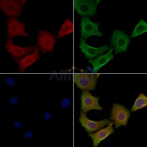 STMN4 Antibody - DF4547 staining Hela cells by IF/ICC.