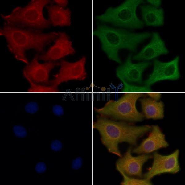 SVOP Antibody - DF4551 staining Hela cells by IF/ICC.