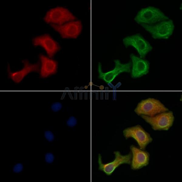 MTERF Antibody - DF4576 staining Hela cells by IF/ICC.