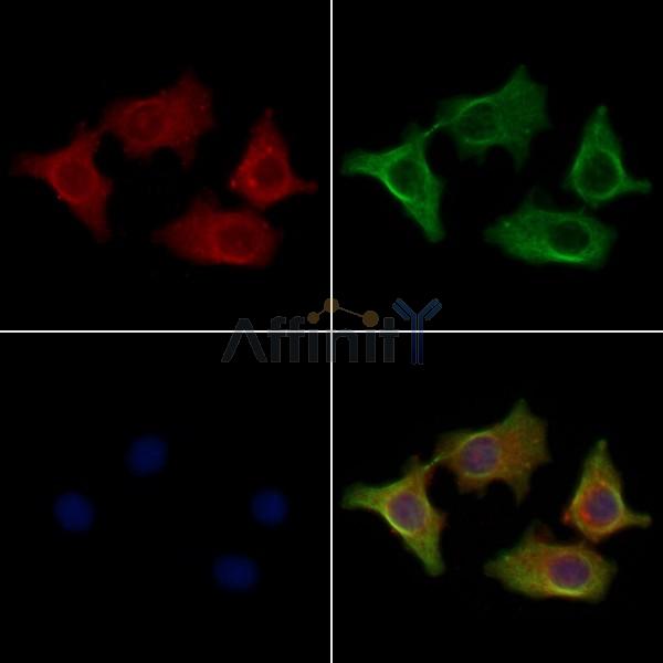SFT2B Antibody - DF4608 staining Hela cells by IF/ICC.