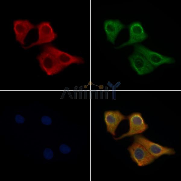 STK17B Antibody - DF4777 staining Hela cells by IF/ICC.
