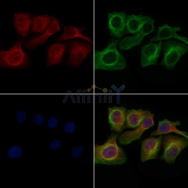 GPR150 Antibody - DF4895 staining Hela cells by IF/ICC.
