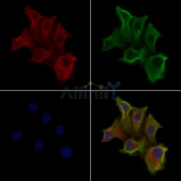 GPR160 Antibody - DF4899 staining Hela cells by IF/ICC.