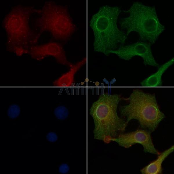 OR2M2 Antibody - DF5077 staining Hela cells by IF/ICC.