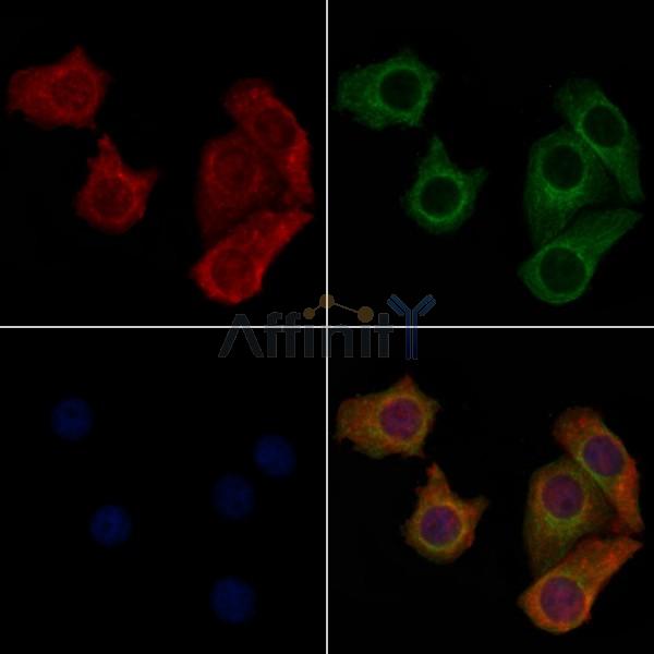 PEVR1 Antibody - DF5141 staining Hela cells by IF/ICC.
