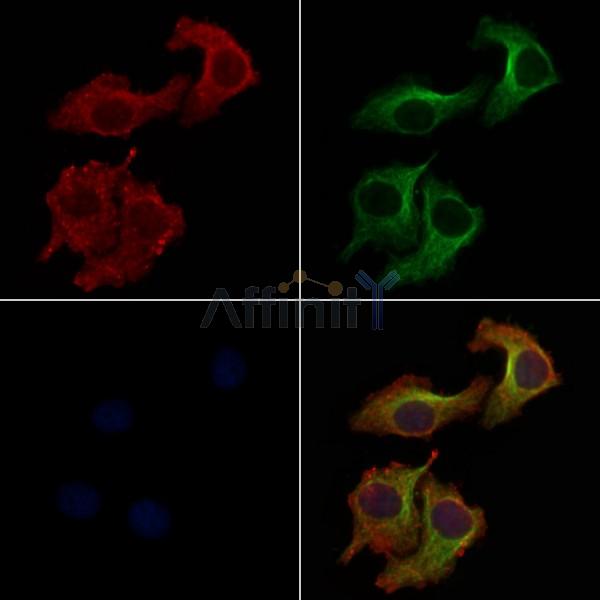 PKR1 Antibody - DF5144 staining Hela cells by IF/ICC.