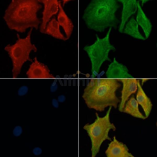 OR10R2 Antibody - DF5183 staining A549 cells by IF/ICC.