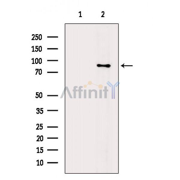 APP Antibody - Western blot analysis of extracts from Hela cells(H2O2 treatment), using APP Antibody.