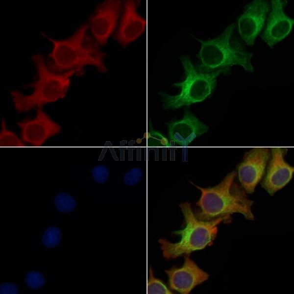 IL18 Antibody - DF6252 staining Hela cells by IF/ICC.