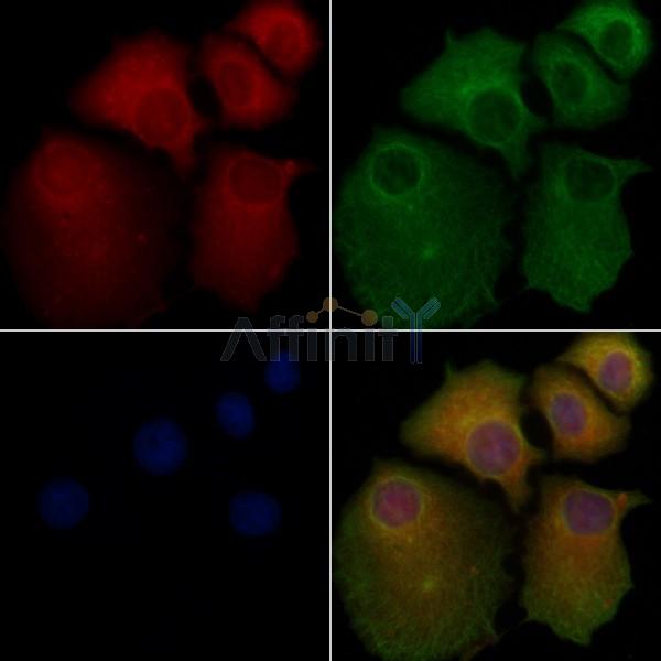 DHFR Antibody - DF6495 staining Hela cells by IF/ICC.