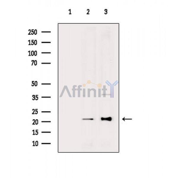 DHFR Antibody - Western blot analysis of extracts from various samples, using DHFR Antibody.