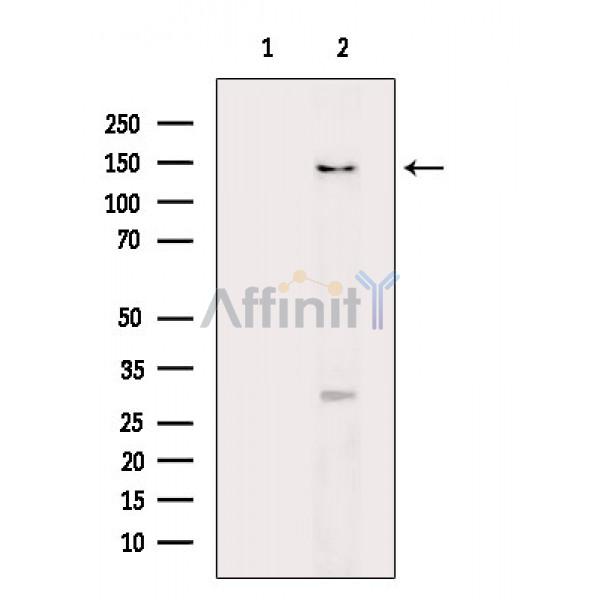 DCTN1 Antibody - Western blot analysis of extracts from Mouse lung, using DCTN1 Antibody.