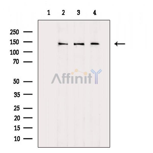 DCTN1 Antibody - Western blot analysis of extracts from various samples, using DCTN1 Antibody.