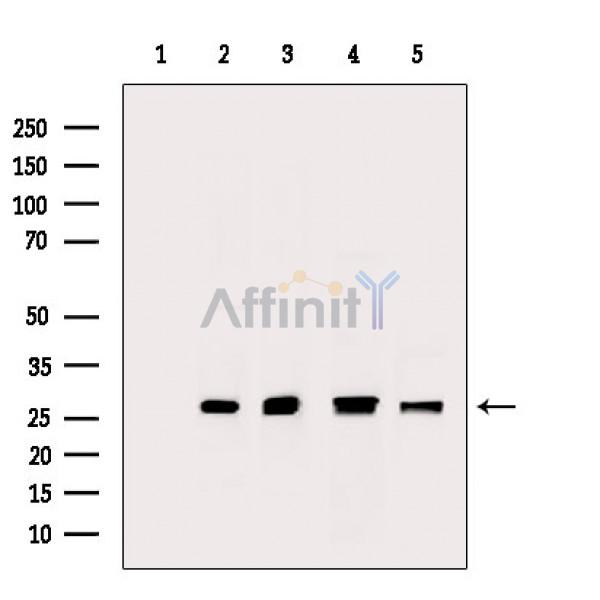 Peroxiredoxin 2 Antibody - Western blot analysis of extracts from various samples, using Peroxiredoxin 2 Antibody.