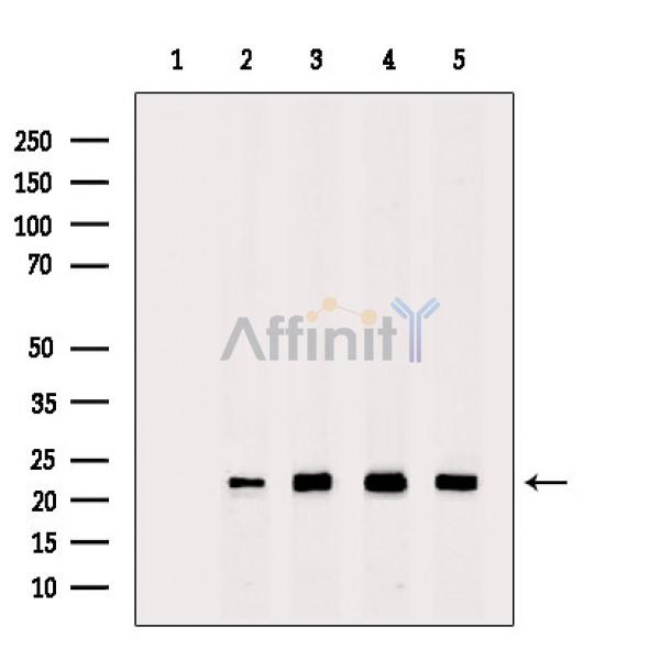 Peroxiredoxin 2 Antibody - Western blot analysis of extracts from various samples, using Peroxiredoxin 2 Antibody.