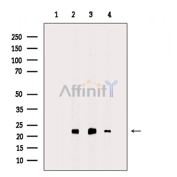 Peroxiredoxin 2 Antibody - Western blot analysis of extracts from various samples, using Peroxiredoxin 2 Antibody.