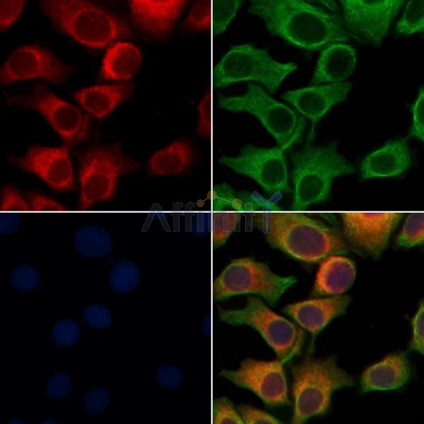 RAB27A Antibody - DF6702 staining Hela cells by IF/ICC.