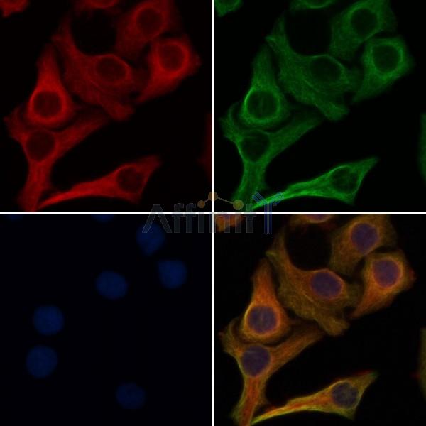TIE2 Antibody - DF7500 staining Hela cells by IF/ICC.