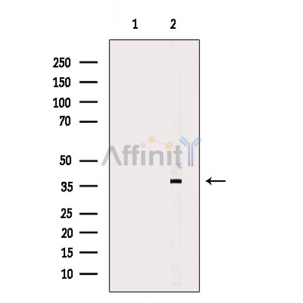 CEACAM6 Antibody - Western blot analysis of extracts from PC12 cells(heat shock treatment), using CEACAM6 Antibody.