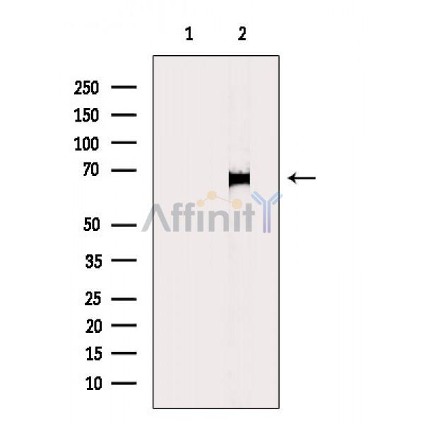 Involucrin Antibody - Western blot analysis of extracts from HepG2 cells, using Involucrin Antibody.