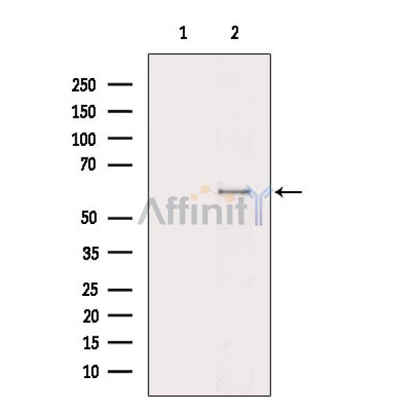 Smad4 Antibody - Western blot analysis of extracts from 373-L1P6(LPS 4h treatment), using Smad4 Antibody.