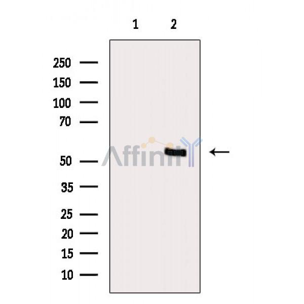 Phospho-AKT1 (Thr450) Antibody - Western blot analysis of extracts from RAW264.