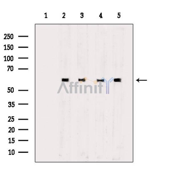 Phospho-Tip60 (Ser90) Antibody - Western blot analysis of extracts from various samples, using Phospho-Tip60 (Ser90) Antibody.