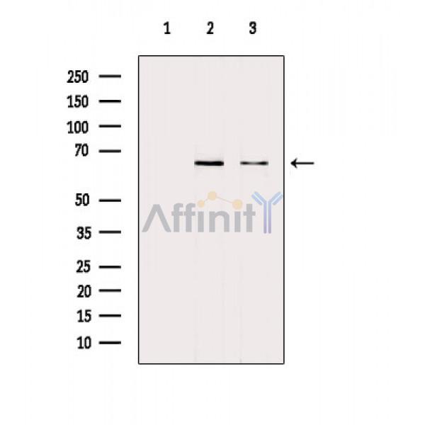 NF-kB p65 Antibody - Western blot analysis of extracts from various samples, using NF-kB p65 Antibody.