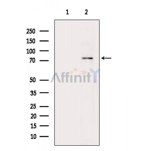 Phospho-PKC beta 1 (Ser661) Antibody - Western blot analysis of extracts from Mouse brain, using Phospho-PKC beta 1 (Ser661) Antibody.