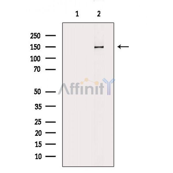 CAF1A Antibody - Western blot analysis of extracts from 293 cells, using CAF1A Antibody.