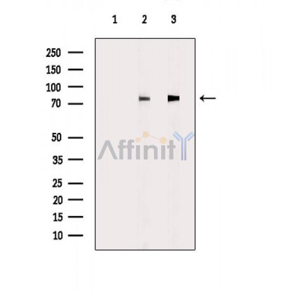 HLX1 Antibody - Western blot analysis of extracts from various samples, using HLX1 Antibody.